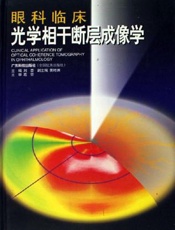 眼科临床光学相干断层成像学