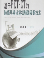 基于PET-CT的肺癌早期计算机辅助诊断技术-赵涓涓