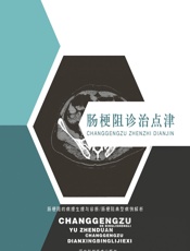 肠梗阻诊治点津-李中信，贾漪涛